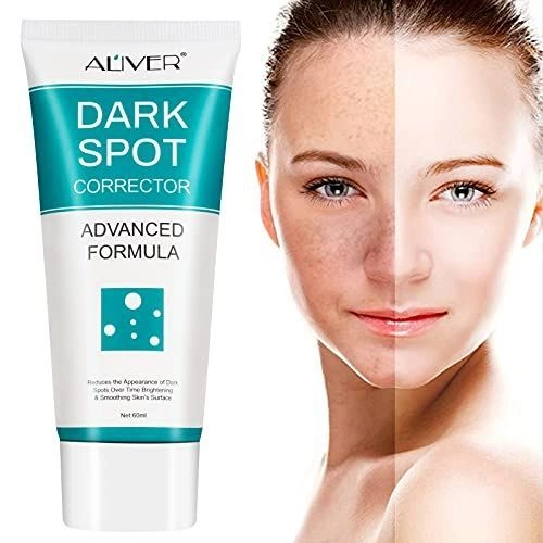 Whitening Face Cream Dark Spot Corrector Remover - كريم تبييض الوجه لإزالة النمش والبقع الداكنة 