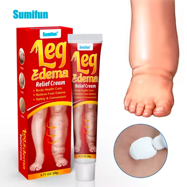 Leg Edema للتورم