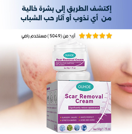 كريم إزالة الندبات و آثار الحروق