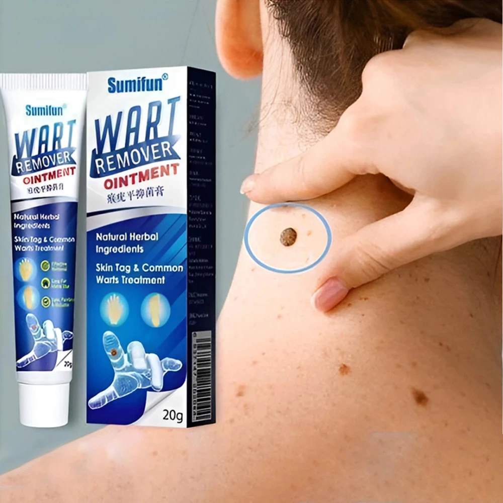 Wart Remover Ointment Cream Skin كريم مرهم مزيل للثآليل للبشرة