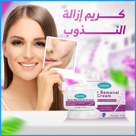 ✨ كريم إزالة الندوب – استرجعي بشرة ناعمة وخالية من العيوب!