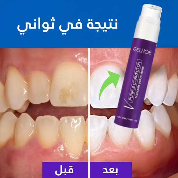 سيروم تبييض الأسنان EELHOE - تركيبة نباتية فعّالة تعمل على تفتيح لون الأسنان تدريجيًا.