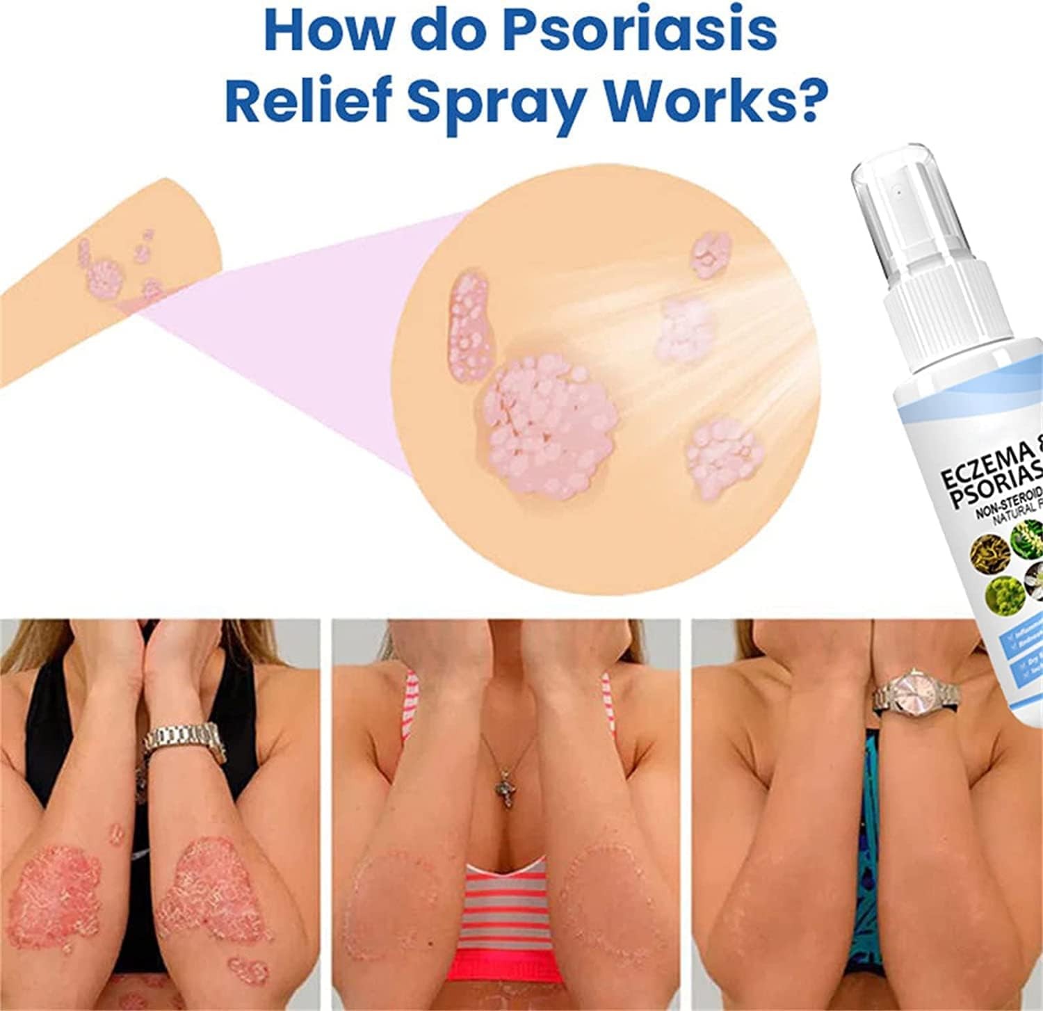 🌿 بخاخ علاج الصدفية والإكزيما بالأعشاب الطبيعية – رذاذ مهدئ ومغذٍ للبشرة