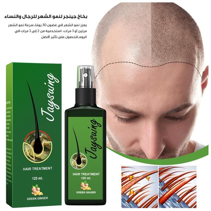 🌿 مصل زيت الزنجبيل المغذي لتعزيز نمو الشعر – Hair Growth Spray