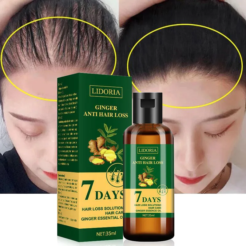 🧴 زيت الزنجبيل من ليدوريا – علاج تساقط الشعر خلال 7 أيام (قطعتين × 60 مل)
