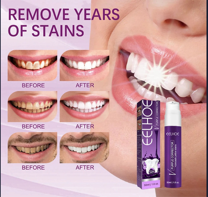 سيروم تبييض الأسنان EELHOE - تركيبة فعّالة مستخلصة من نباتات طبيعية تساعد على تفتيح لون الأسنان تدريجياً بدون حساسية أو ضرر على المينا.