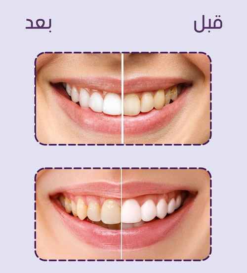 funnel.sf_single_image
