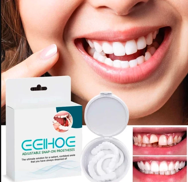 طقم أسنان قابل للضبط