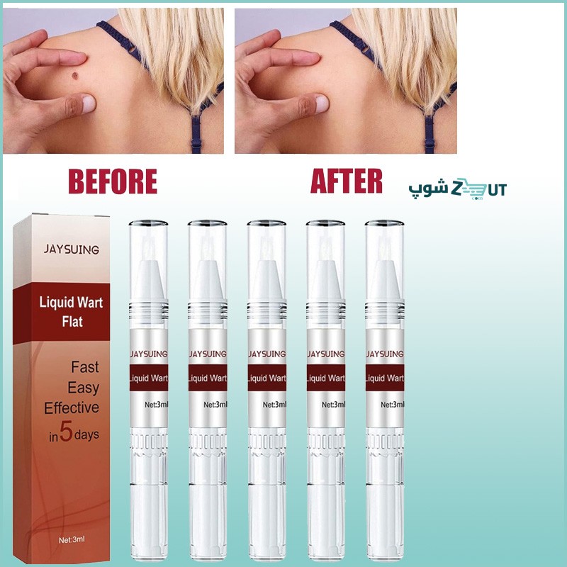 كريم إزالة الثآليل والزوائد الجلدية - Skin Tag Remover and Wart Removal Pen
