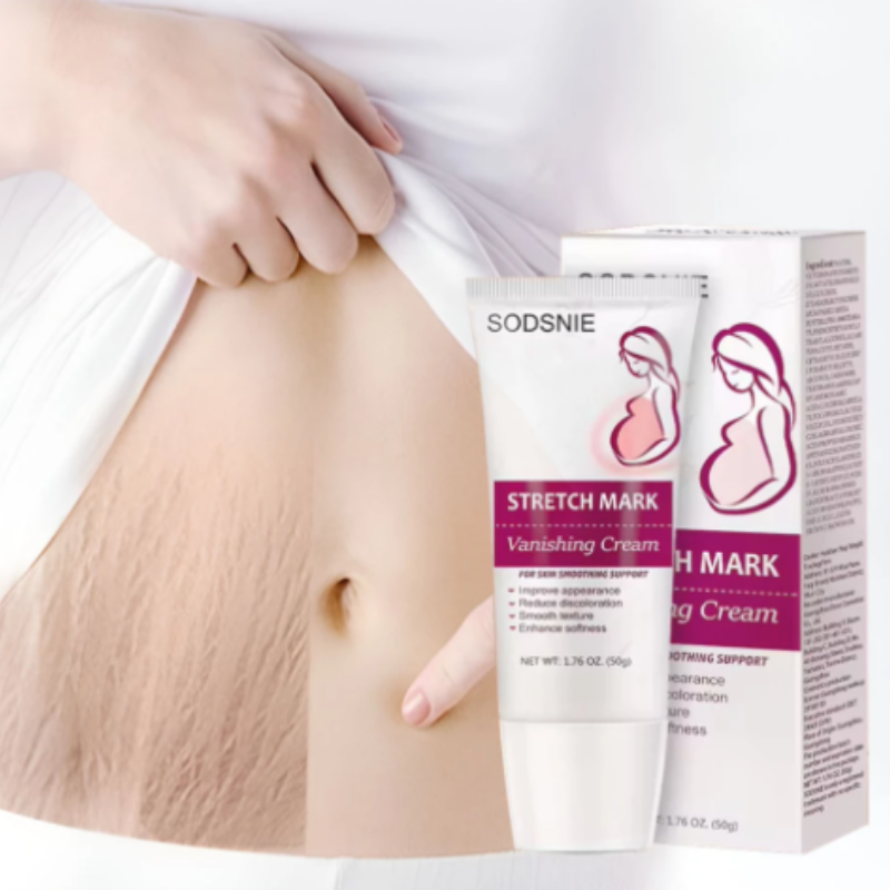 Stretch Marks Permanent Removal Cream – كريم إزالة علامات التمدد بشكل دائم