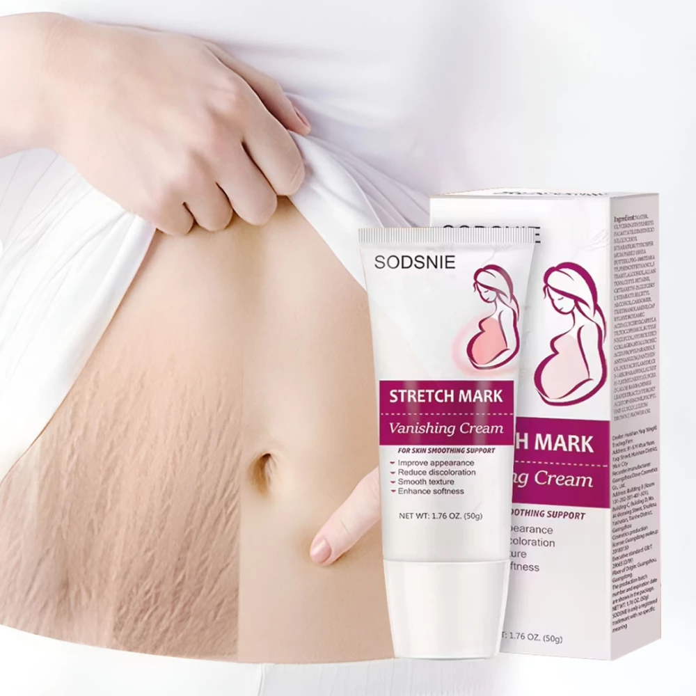 Stretch Marks Permanent Removal