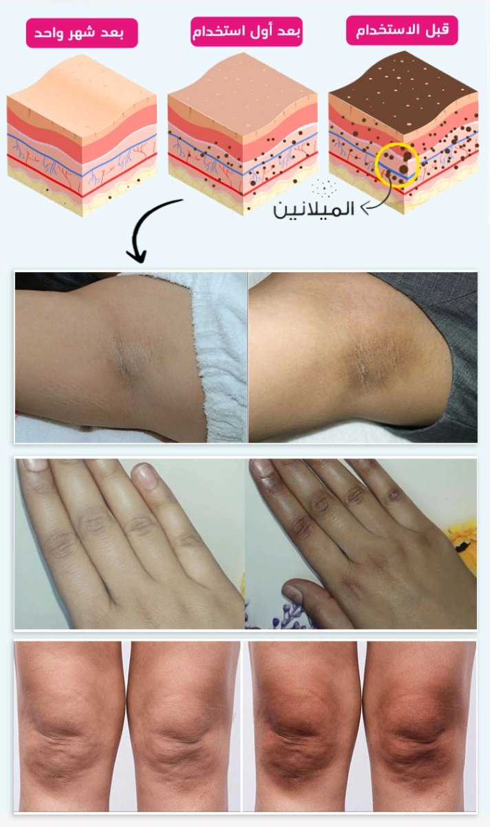 صورة المنتج