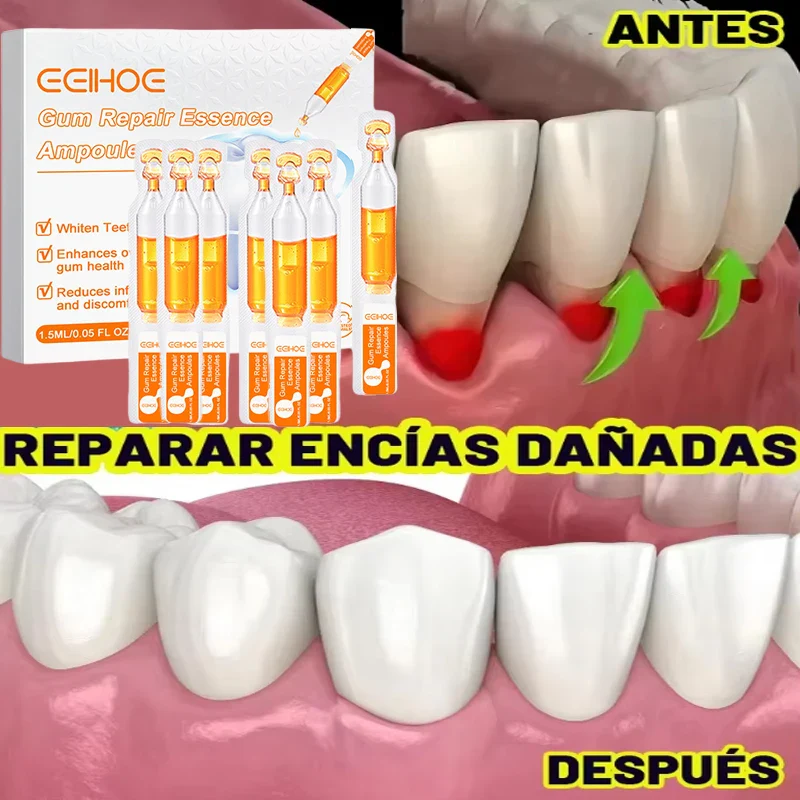 ✨ Traitement Réparateur de Gencives