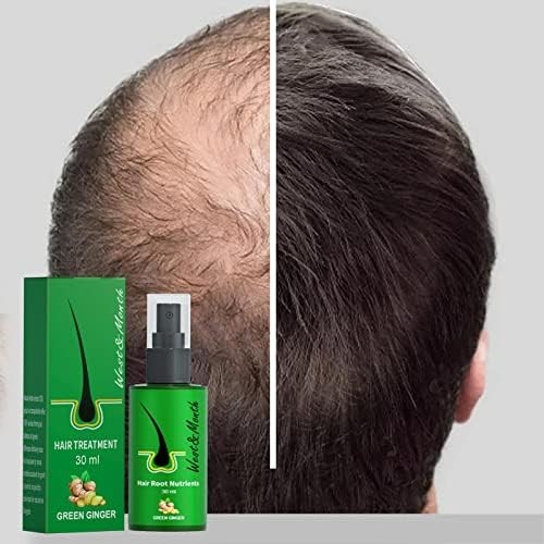 🌱 Spray Croissance Cheveux