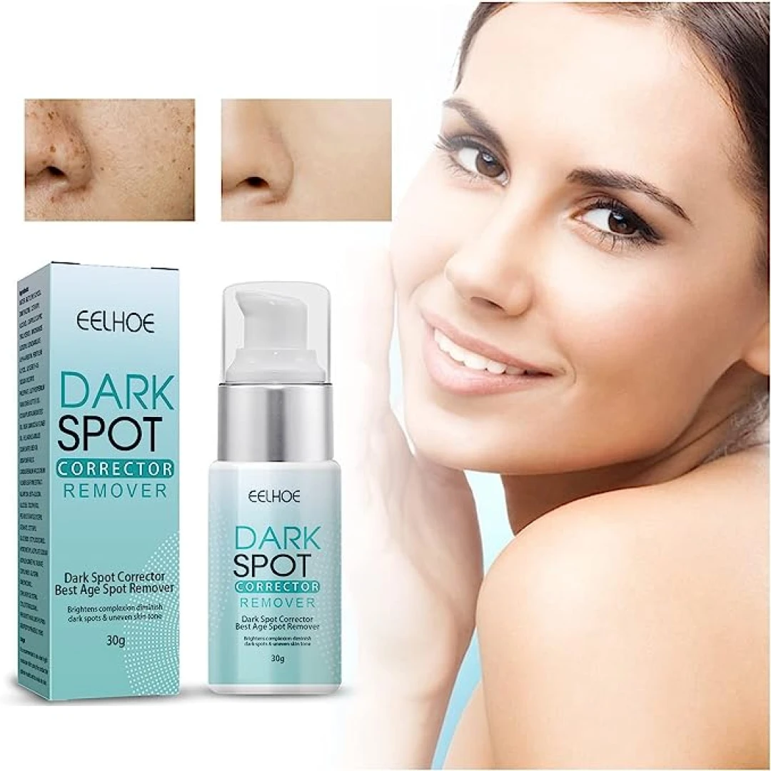 Whitening Face Cream Dark Spot Corrector Remover - كريم تبييض الوجه لإزالة النمش والبقع الداكنة