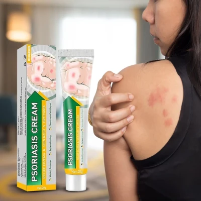 Skin Tinea Care External Cream - كريم لعلاج الصدفية والأكزيما بالأعشاب الطبيعية