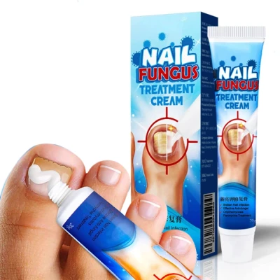 Nail Fungus Treatment Cream / كريم علاج فطريات الأظافر