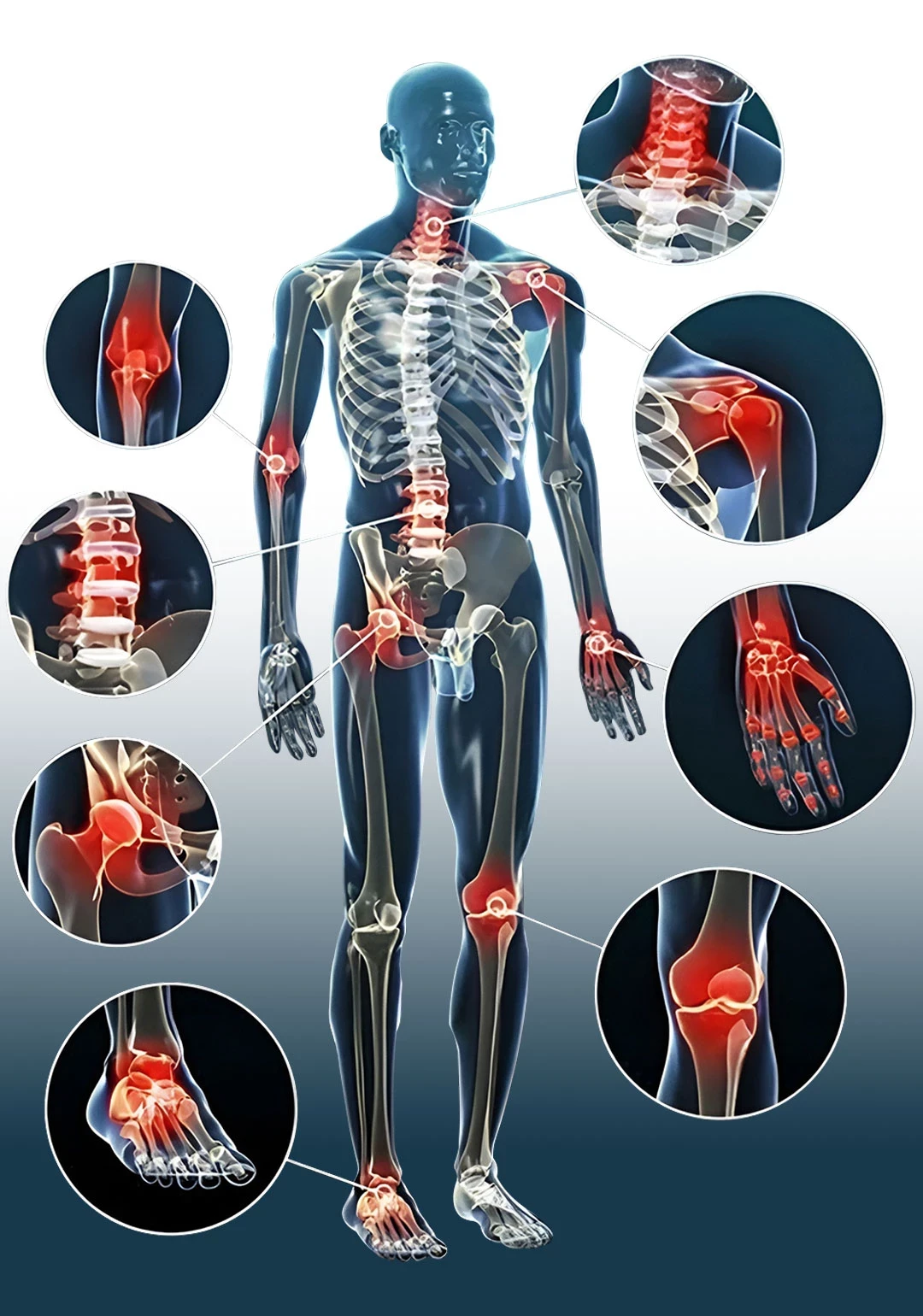 funnel.sf_single_image