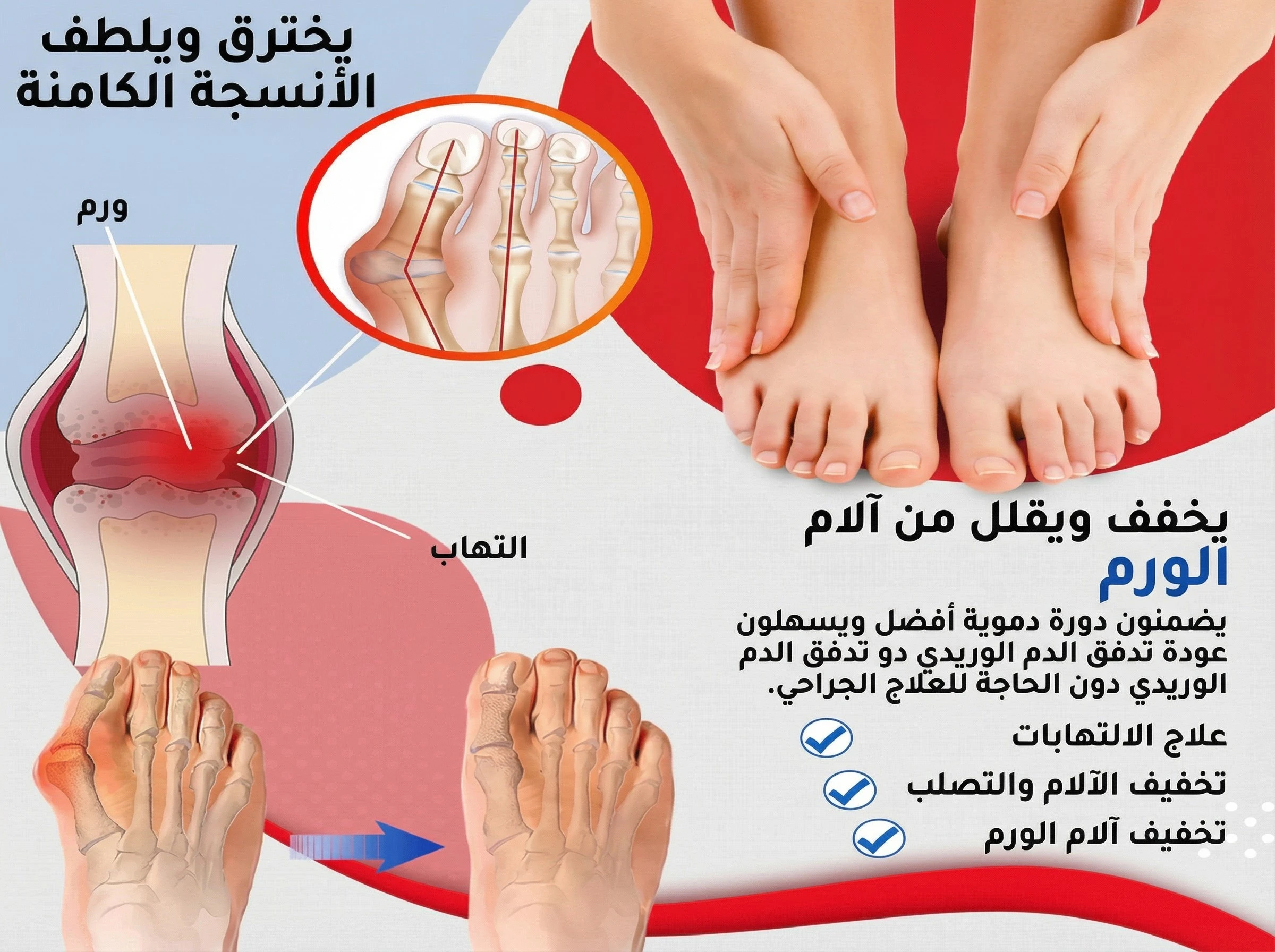 funnel.sf_single_image