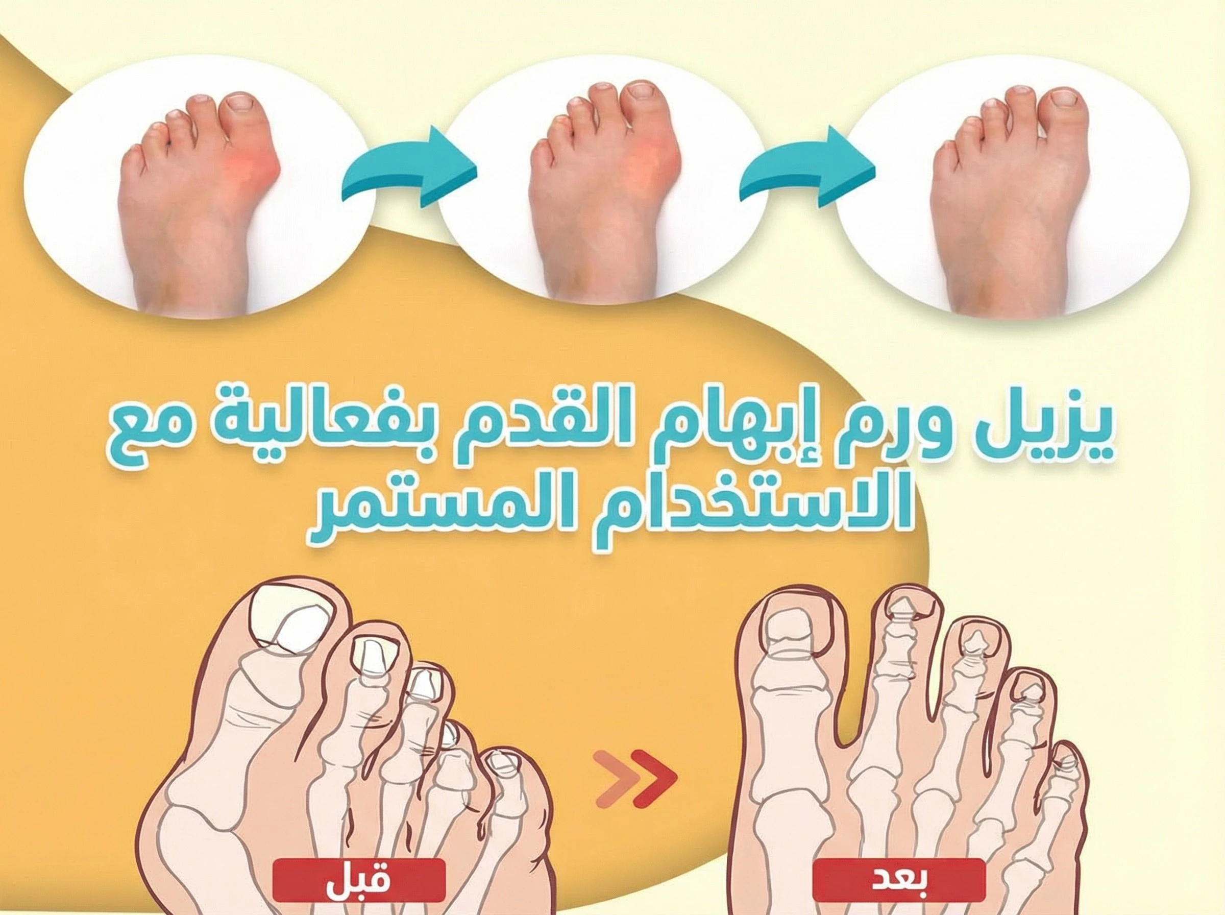 funnel.sf_single_image