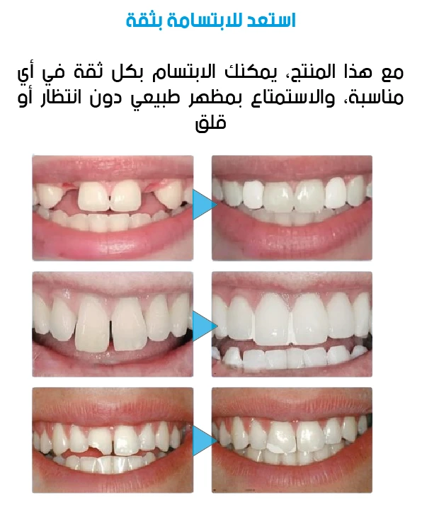 funnel.sf_single_image