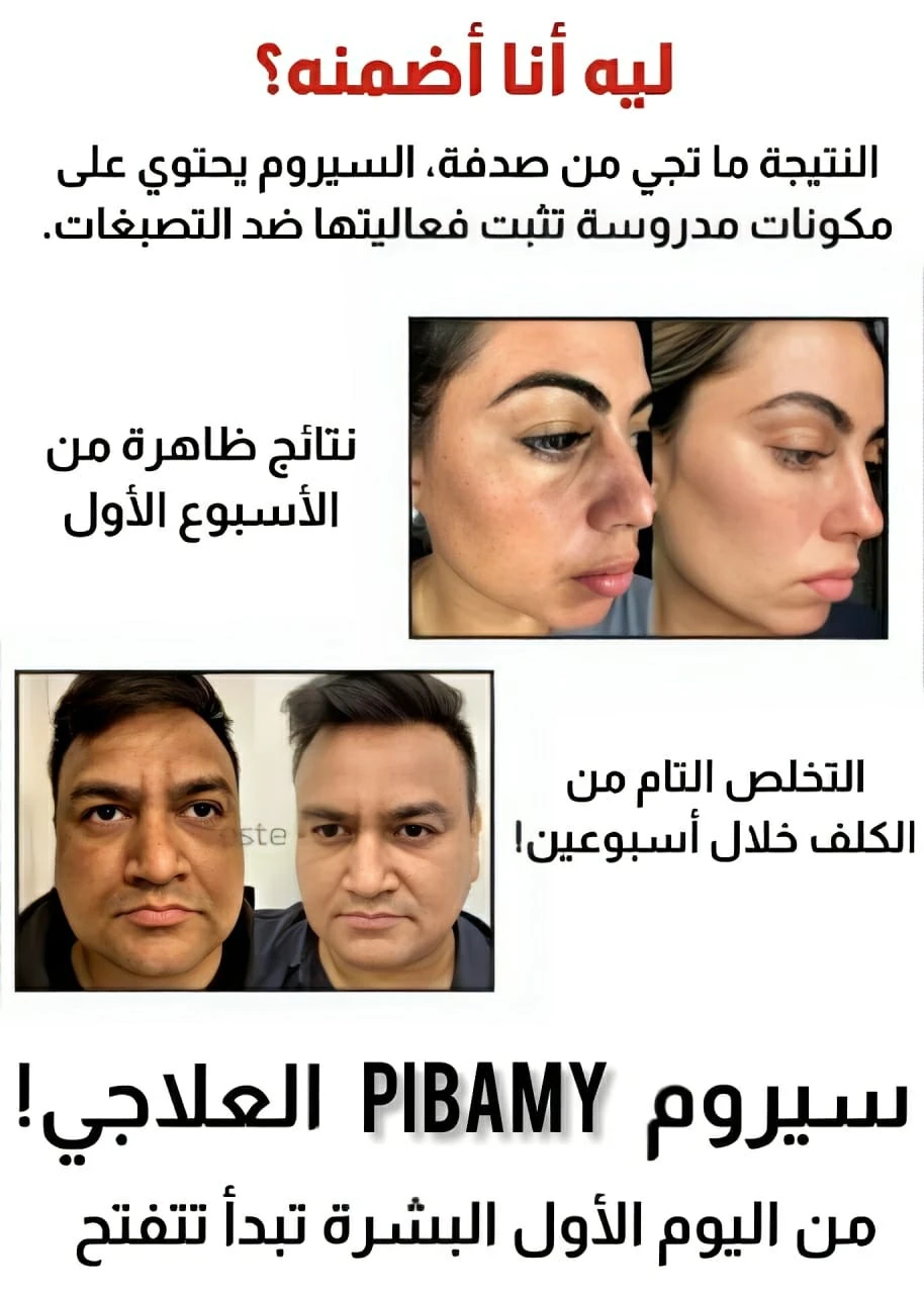 funnel.sf_single_image