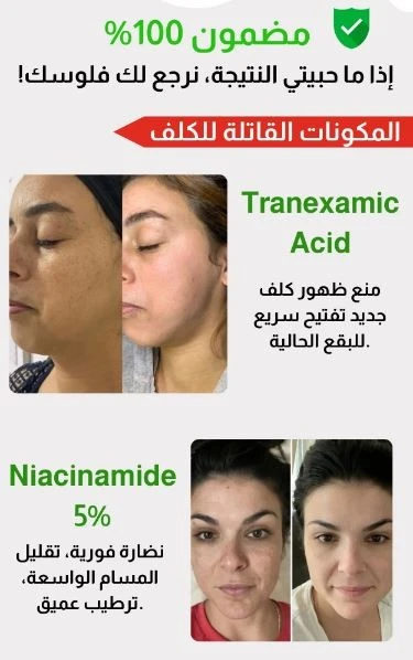 funnel.sf_single_image