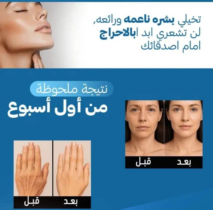 funnel.sf_single_image