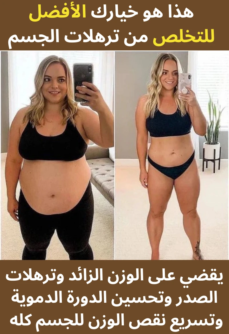 funnel.sf_single_image