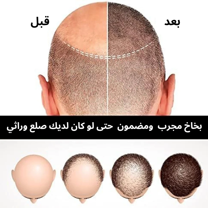 funnel.sf_single_image