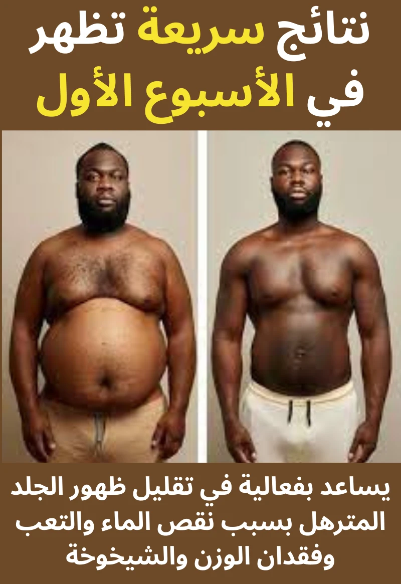 funnel.sf_single_image