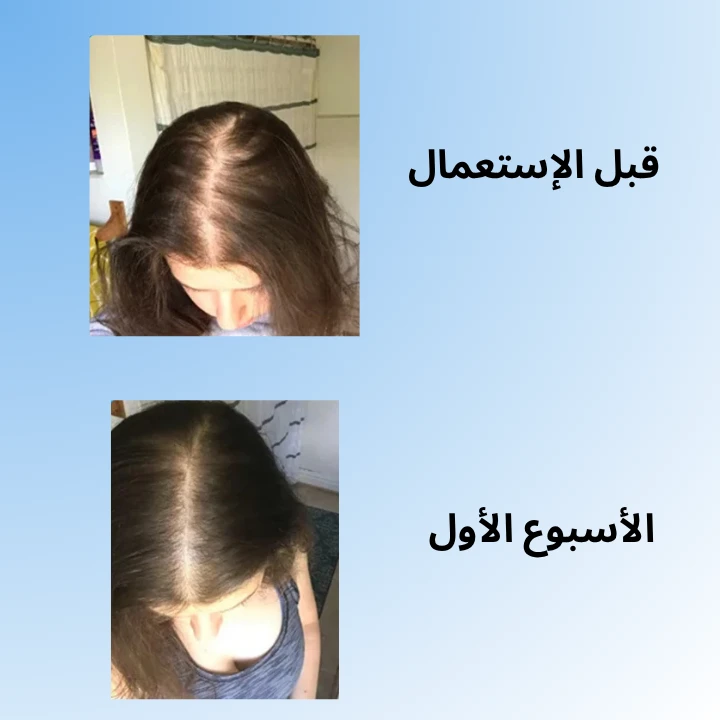 funnel.sf_single_image