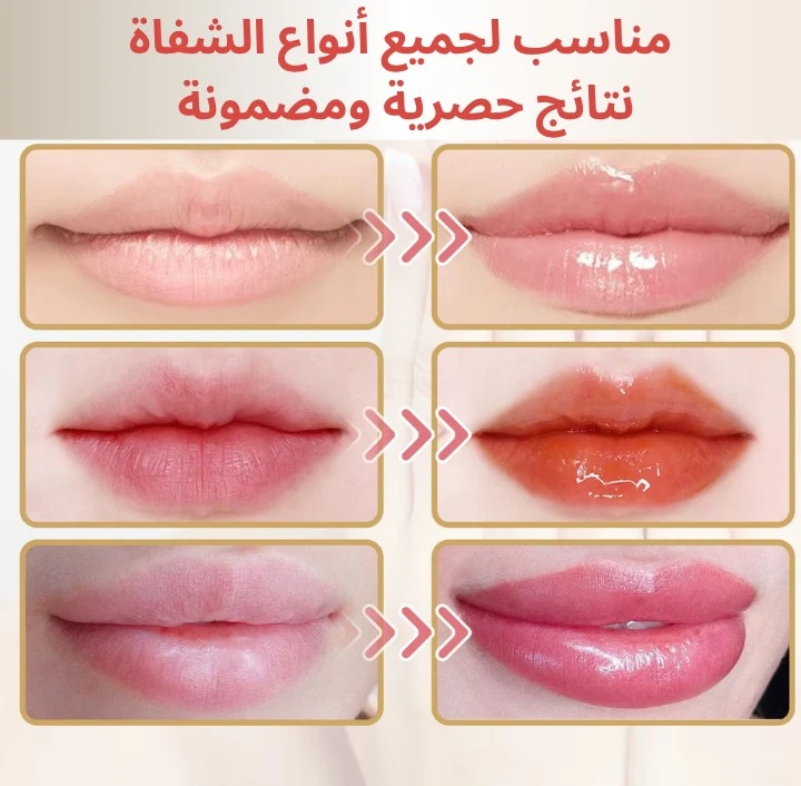 funnel.sf_single_image