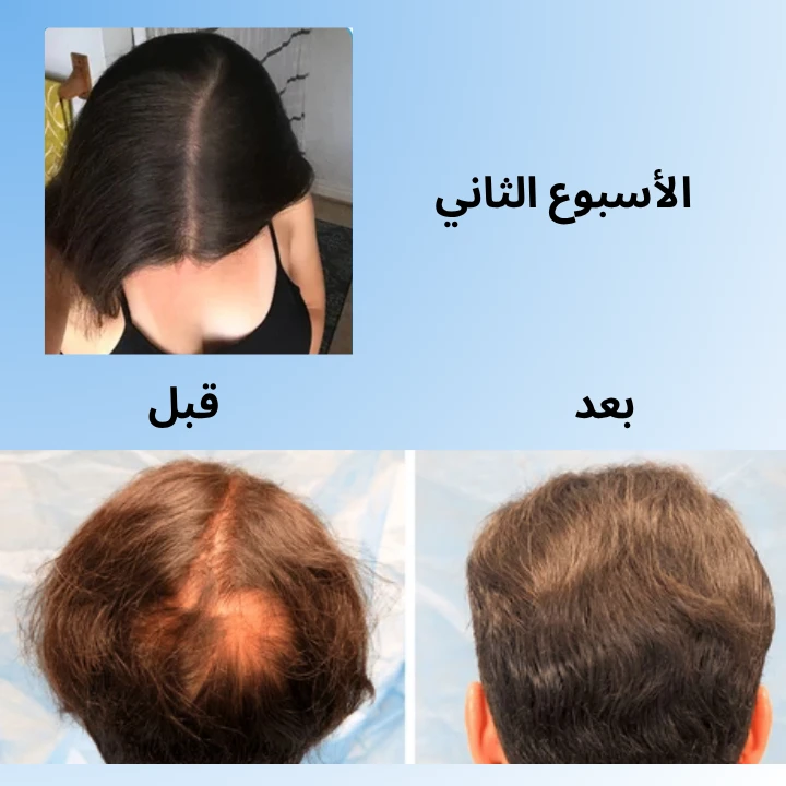 funnel.sf_single_image