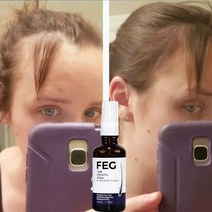 funnel.sf_single_image