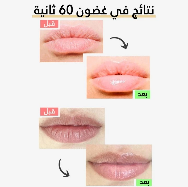 funnel.sf_single_image