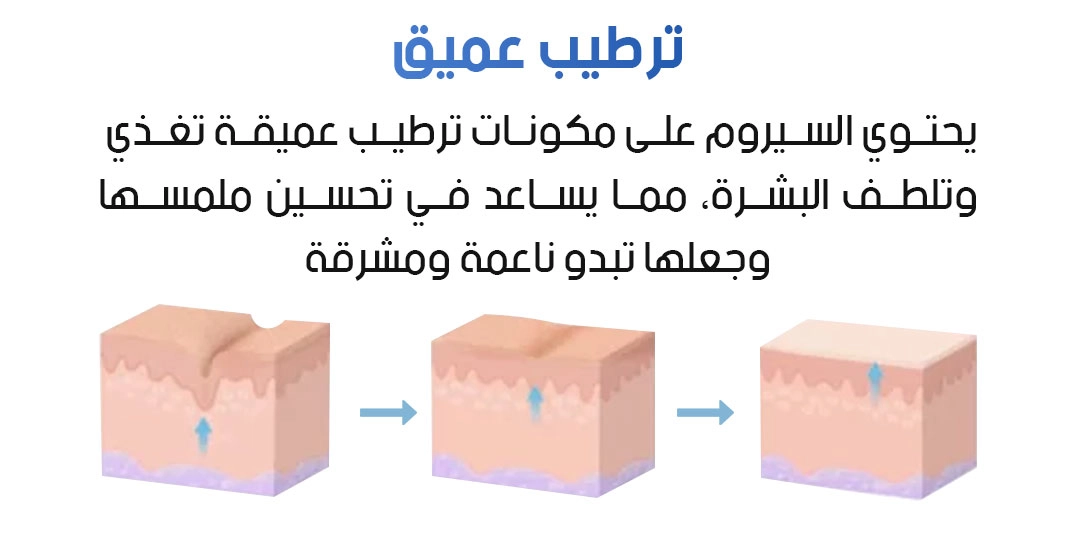 funnel.sf_single_image
