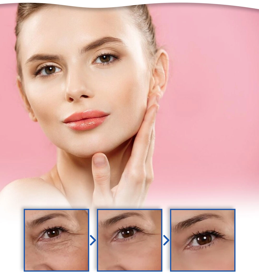 funnel.sf_single_image