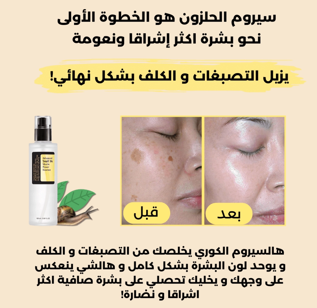 funnel.sf_single_image