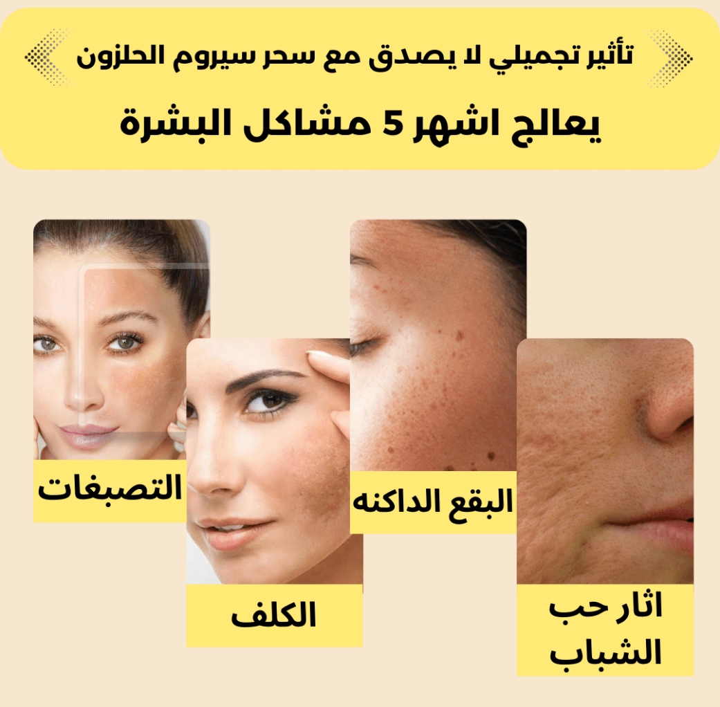 funnel.sf_single_image