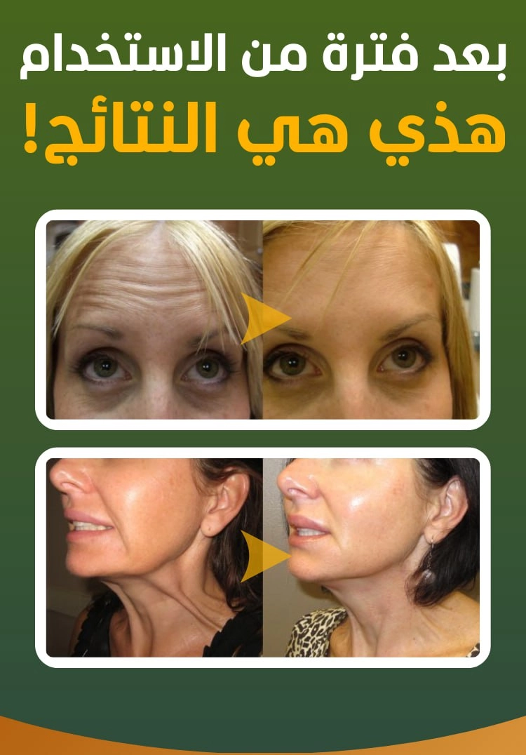 funnel.sf_single_image